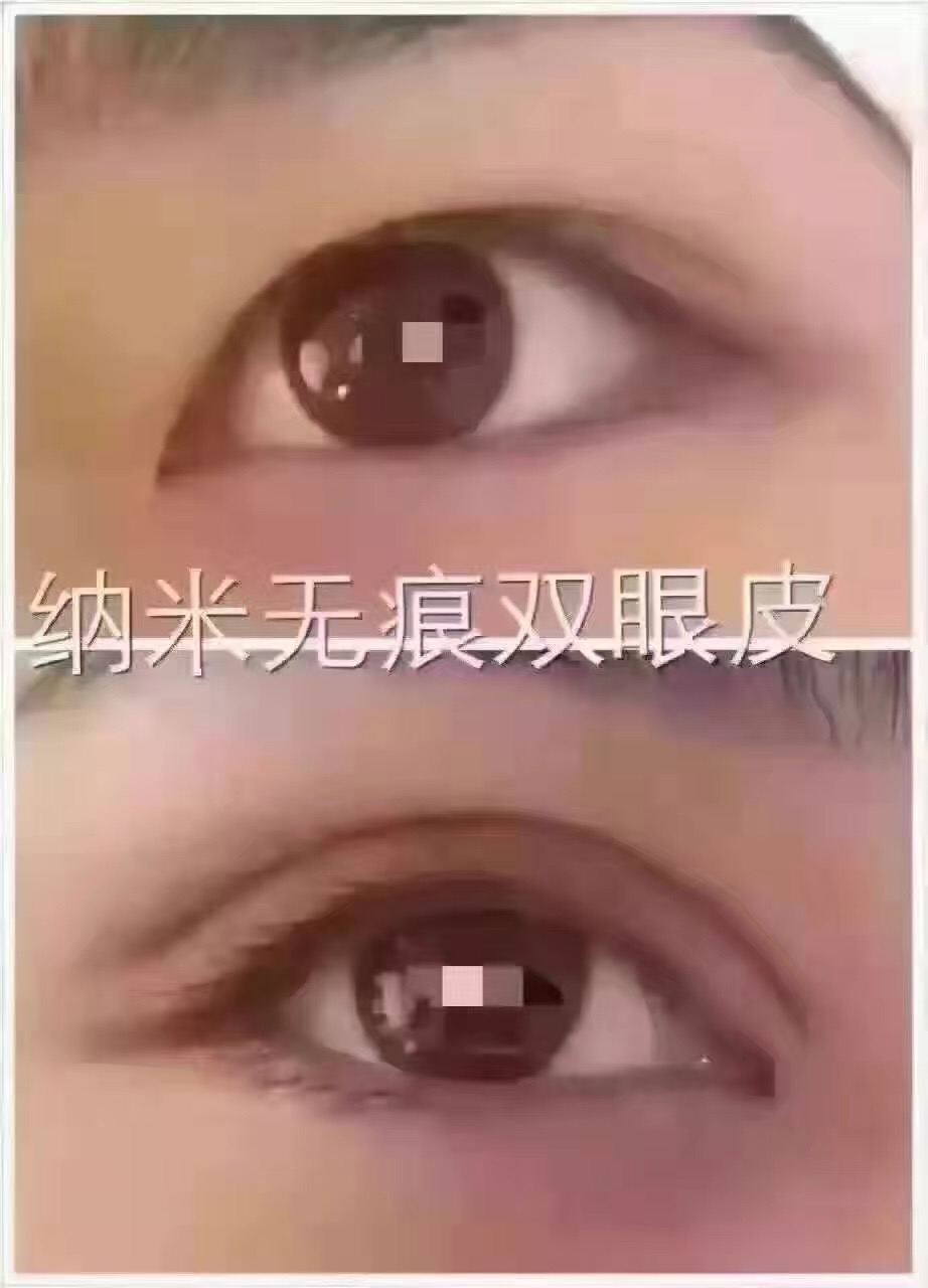 青州赞美神开眼角